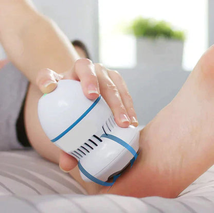 Electric Vacuum Callus Remover – Rechargeable Foot File for Dry & Cracked Heels